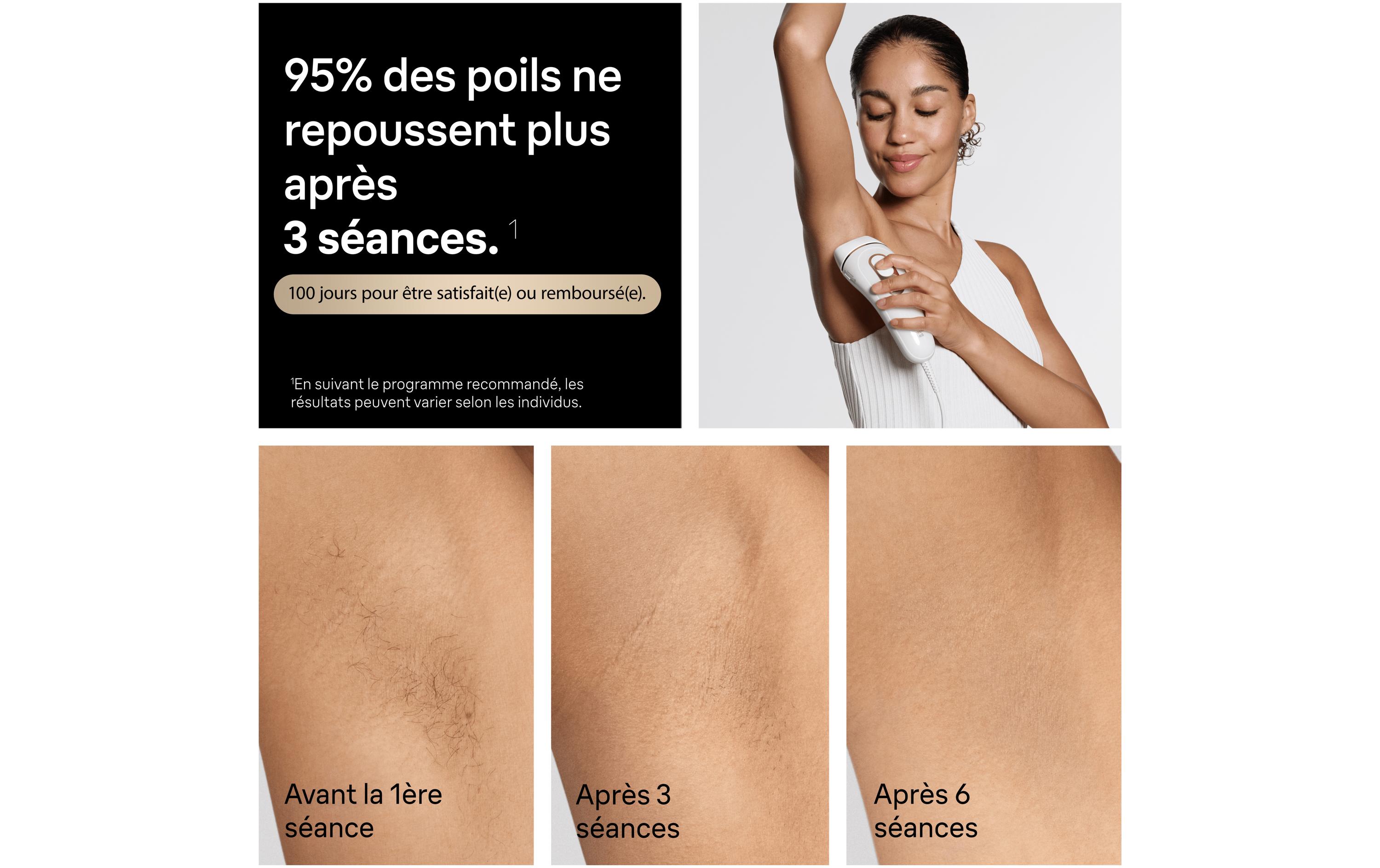 Braun IPL-Haarentferner Silk-expert Pro IPL PL5431