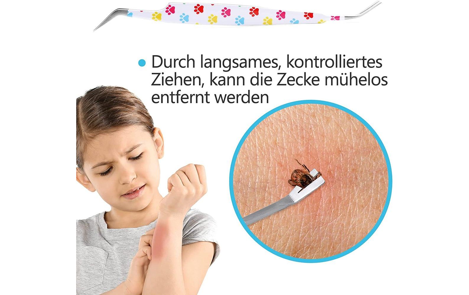 Helperfect Zeckenentferner Weiss