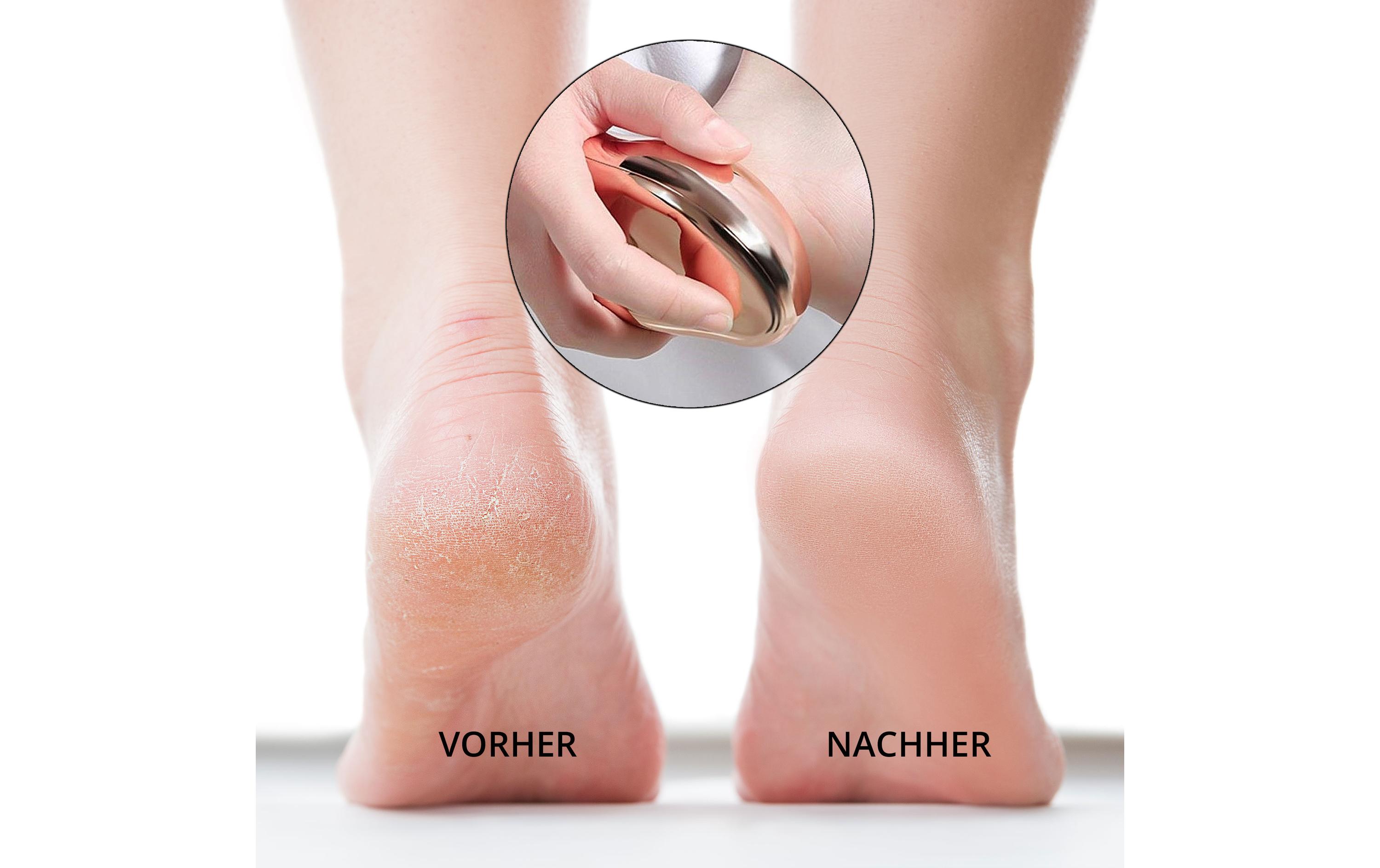 Ailoria Hornhautentferner Doucette Set Violett