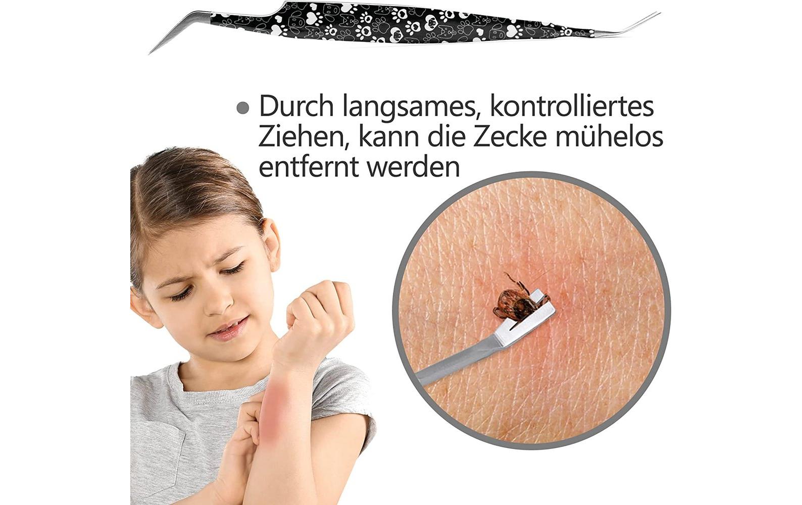 Helperfect Zeckenentferner Schwarz