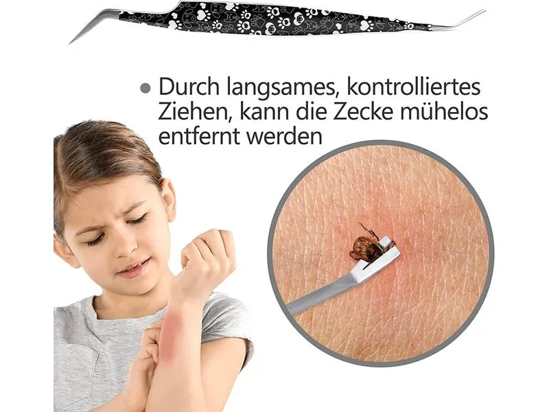 Helperfect Zeckenentferner Schwarz Helperfect Zeckenentferner Schwarz