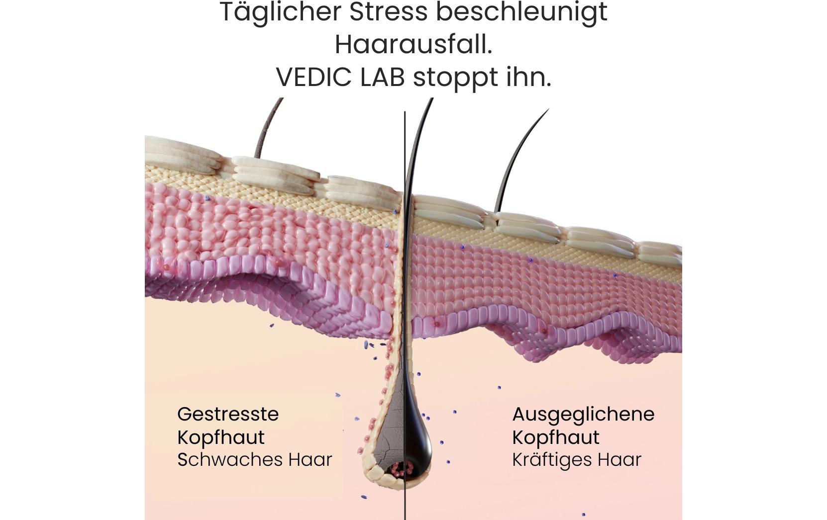 VEDIC Lab Kopfhaut-Elixier 100 ml