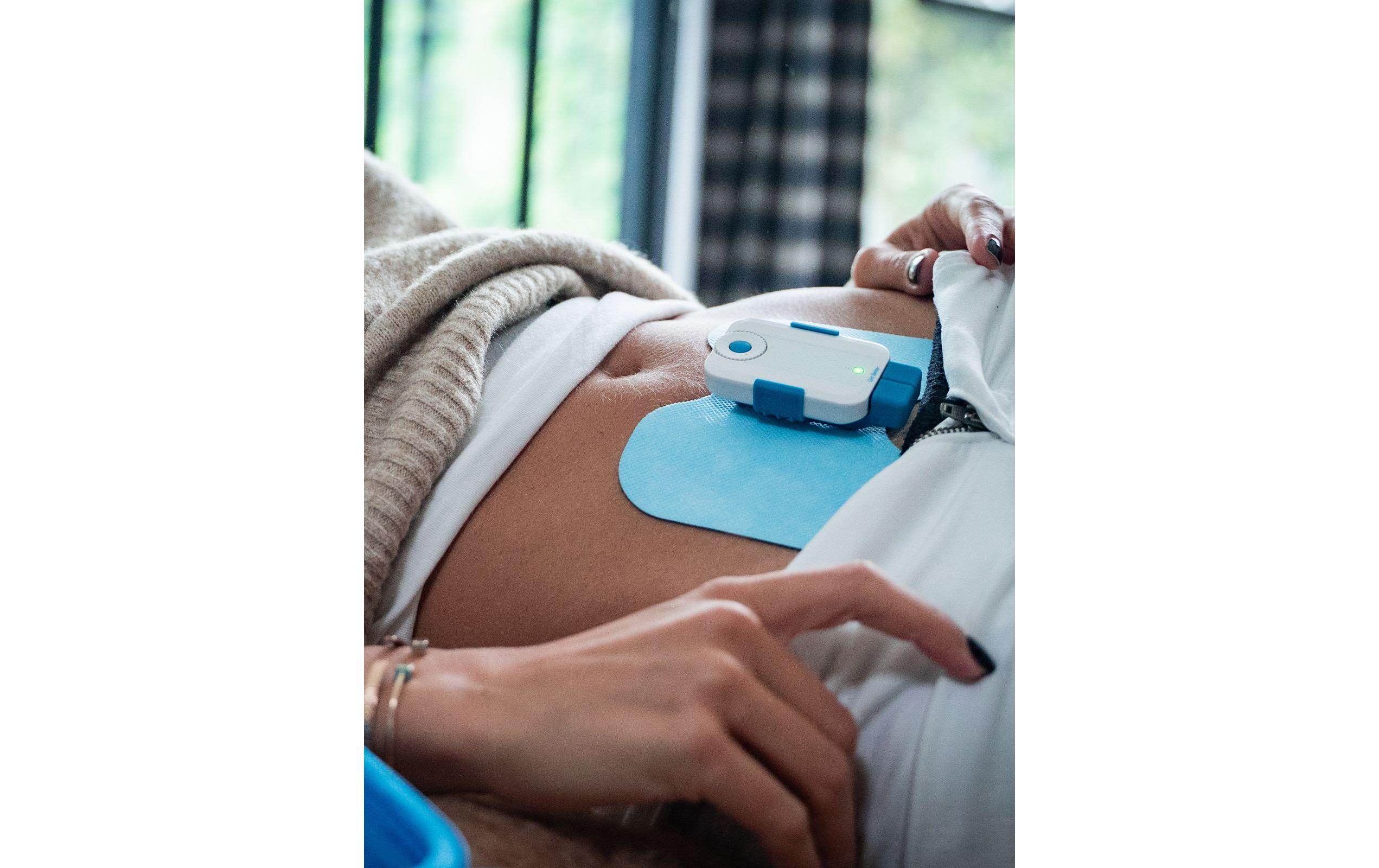 Bluetens Elektroden Papillon 3 Stk. Bluetens Elektroden Papillon 3 Stk.