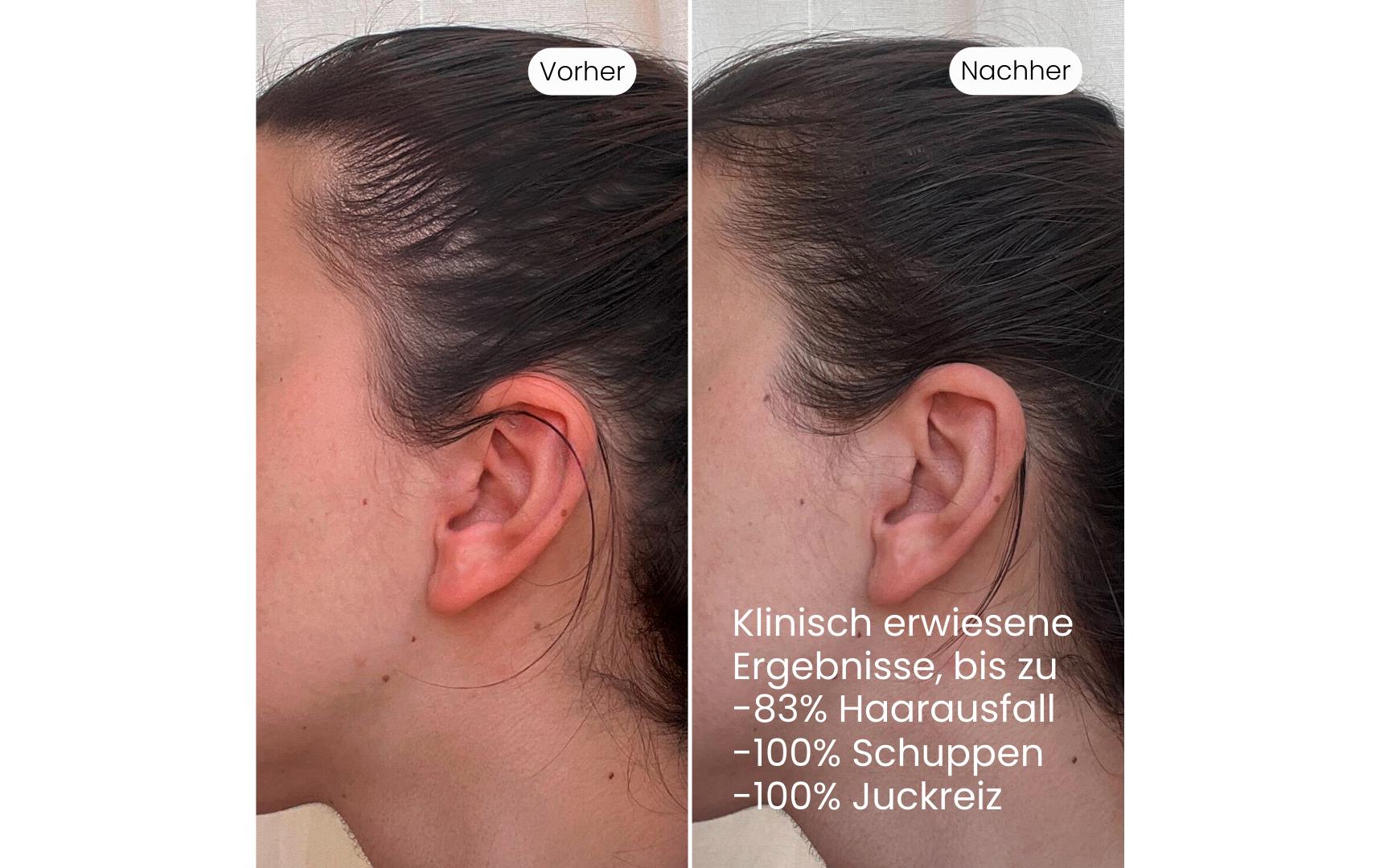 VEDIC Lab Tages-Kopfhaut-Elixier +UV 100 ml