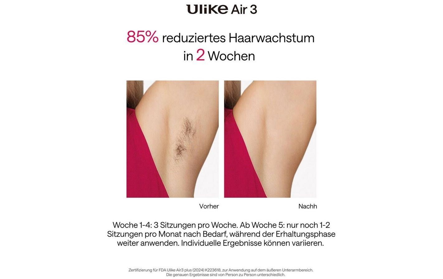 Ulike IPL-Haarentferner Air 3 Plus Lila