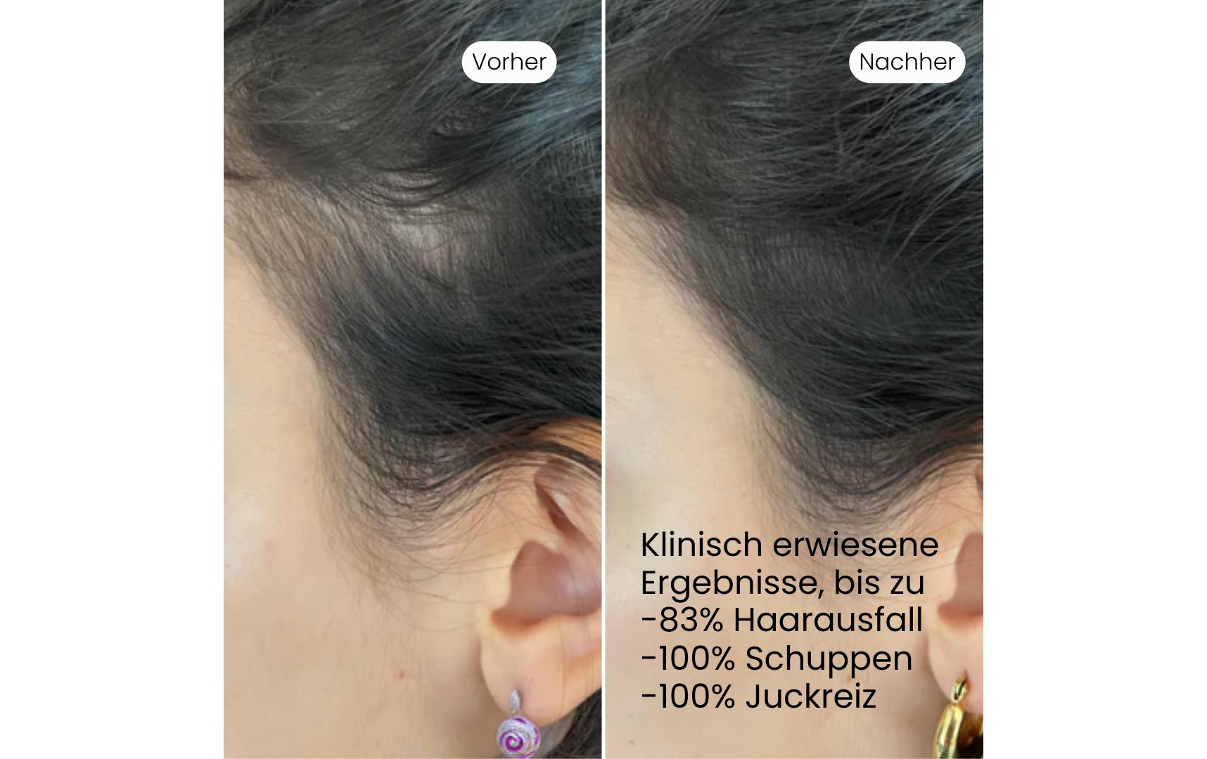 VEDIC Lab Kopfhaut-Elixier 100 ml