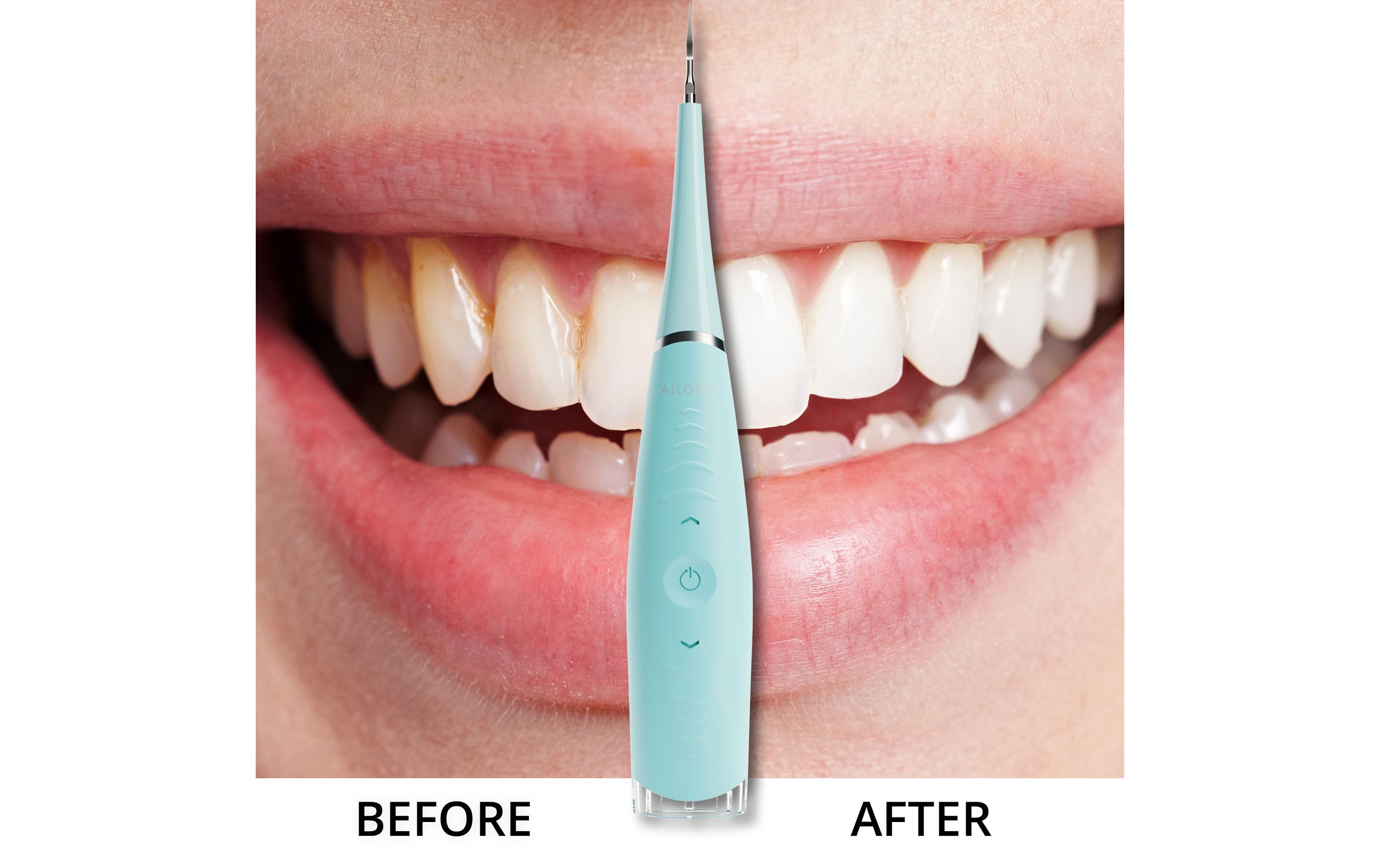 Ailoria Schall-Zahnreiniger Deplaqued Laguna