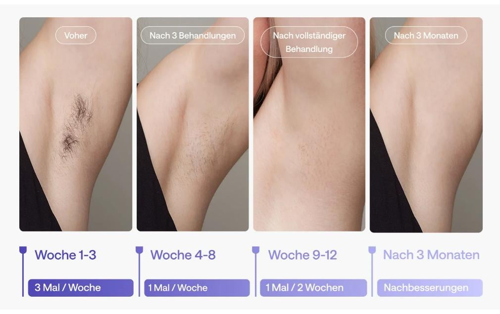 Ulike IPL-Haarentferner Air 3 Lila